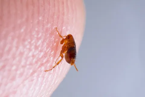 Close-up of a small brown flea on human skin showing detailed texture and fine hairs.