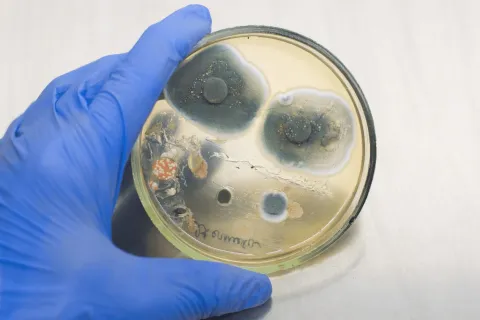 Why Do I Need Mold Testing in My Property?