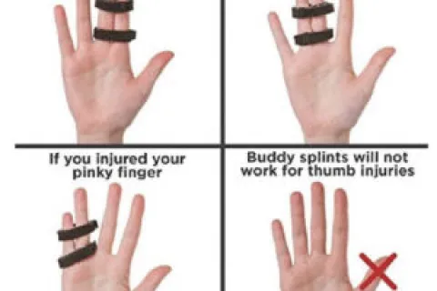 Ulnar Nerve Compression