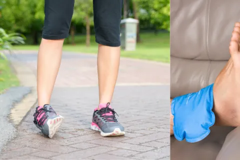 Understanding and Managing Sprained Ankles