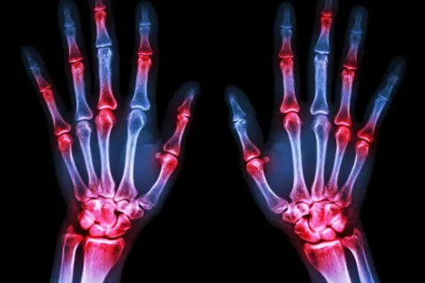 a close-up of a red x-ray