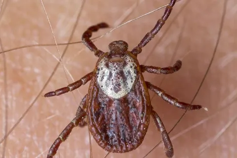 American Dog tick up close
