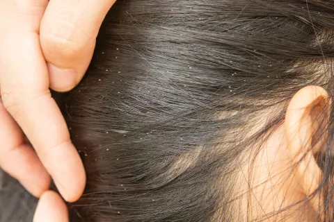 a person's hand holding a hair