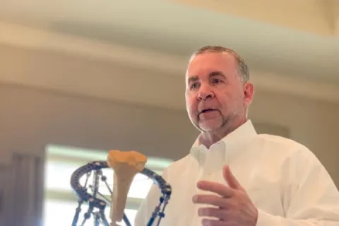 Man in white shirt demonstrating a bone model with surgical external fixation frame indoors near window.