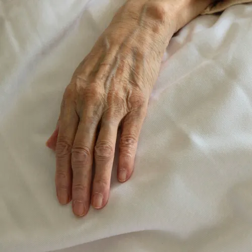 Wrinkled elderly hand resting on white soft fabric with beige sleeve visible.