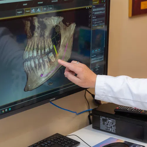 Medical professional pointing at 3D jaw bone scan on computer screen in dental clinic setting