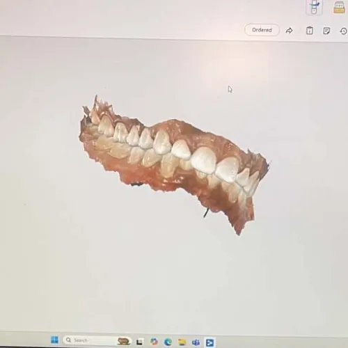 Dell laptop displaying 3D dental scan of teeth with white handheld dental scanner on desk