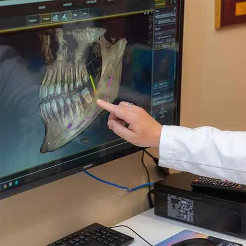 Medical professional pointing at 3D jaw bone scan on computer screen in dental clinic setting