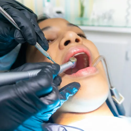 Dentist wearing black gloves treating patient with dental drill and mirror inside clinic.