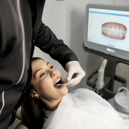 Dentist fitting clear dental aligner on female patient in modern dental clinic with teeth image on screen.