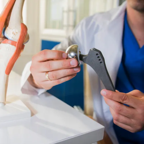 Doctor demonstrating a hip replacement implant next to an anatomical knee joint model on a desk