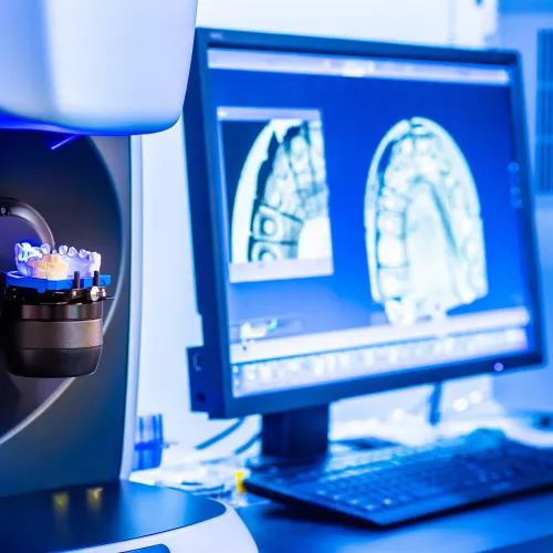 3D dental scanner digitizing a dental mold with computer showing scanned images for dental restoration.