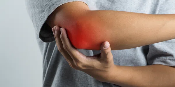 Image of Elbow