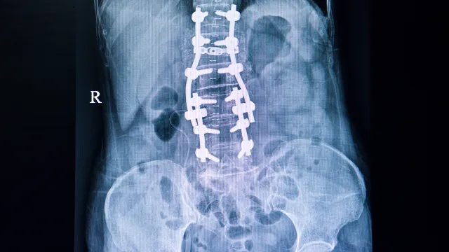 a close-up of a human body