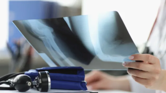 Doctor examining an X-ray image of a leg in a medical office with blood pressure cuff and documents nearby