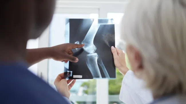 Medical professionals examining a knee joint X-ray for diagnosis and treatment planning.