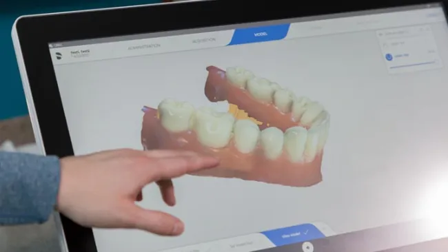 A person interacting with a digital display of a 3D dental model showing teeth and gums.