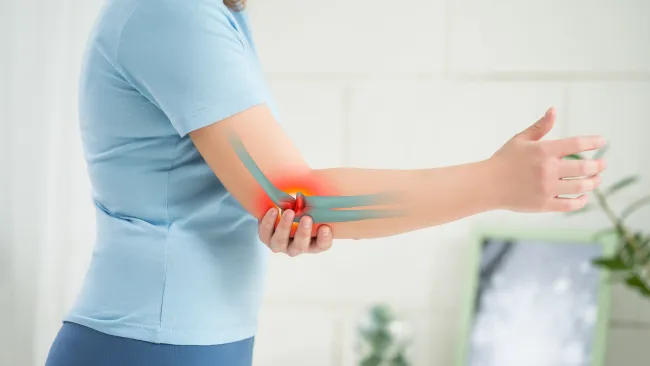 a woman holding her elbow