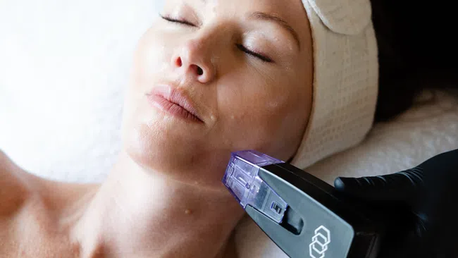 Woman receiving a facial skin treatment with a handheld skincare device at a spa or clinic.