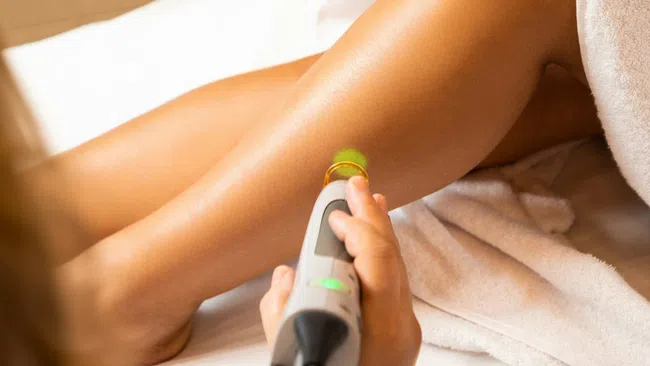 Close-up of laser hair removal treatment being performed on smooth, tanned female legs in spa setting.