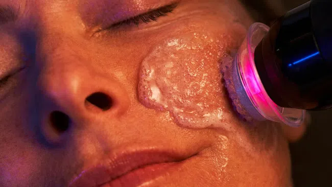 Close-up of a woman's face undergoing a facial treatment with a glowing skincare device and foam cleanser.