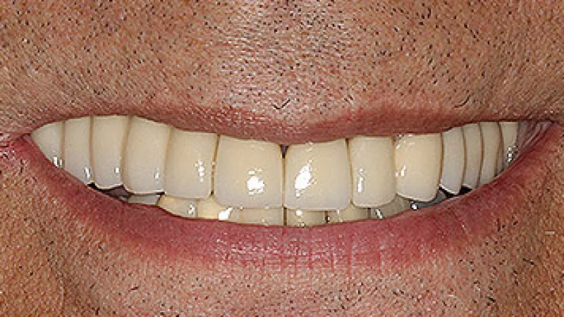 Close-up of a smile showing natural white teeth and lips against textured skin background.