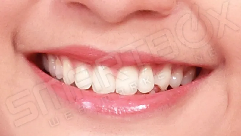 Smile Gallery - Close-up of a smiling woman showcasing bright, healthy teeth and smooth lips.