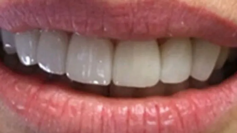 Close-up of a smiling mouth showing straight, white teeth and natural lips.