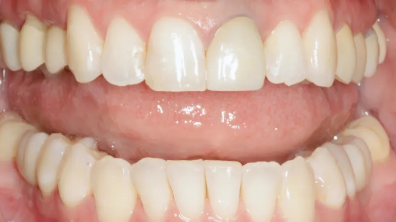 Close-up of healthy human teeth showing upper and lower dental arches with natural color and alignment.