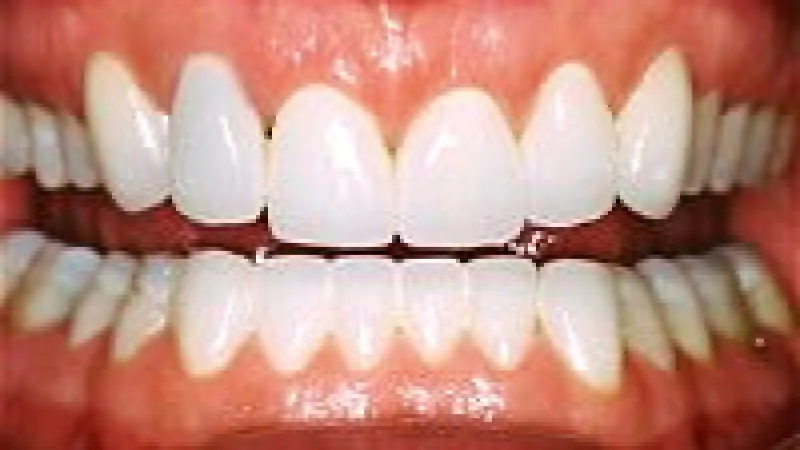 Close-up of a healthy smile showing clean, white teeth and pink gums with natural shine and texture.