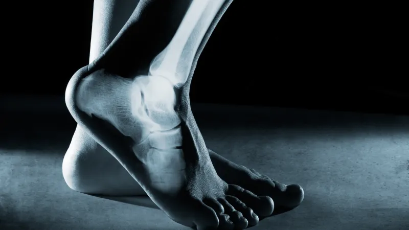 X-ray image showing detailed bones of a human foot and ankle with partial skin overlay on dark background