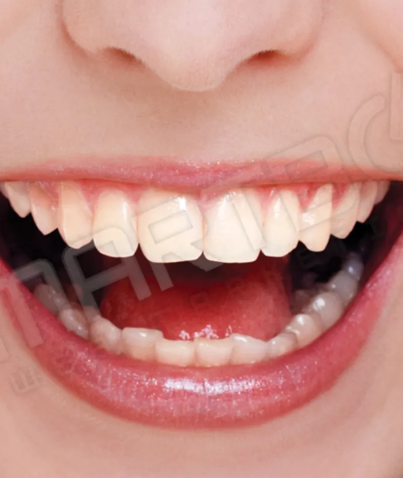 a close-up of a person's mouth