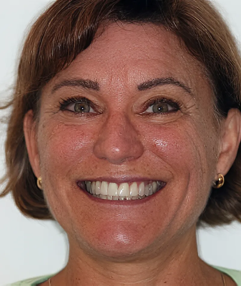 Close-up portrait of a smiling middle-aged woman with short brown hair and gold earrings against a plain background