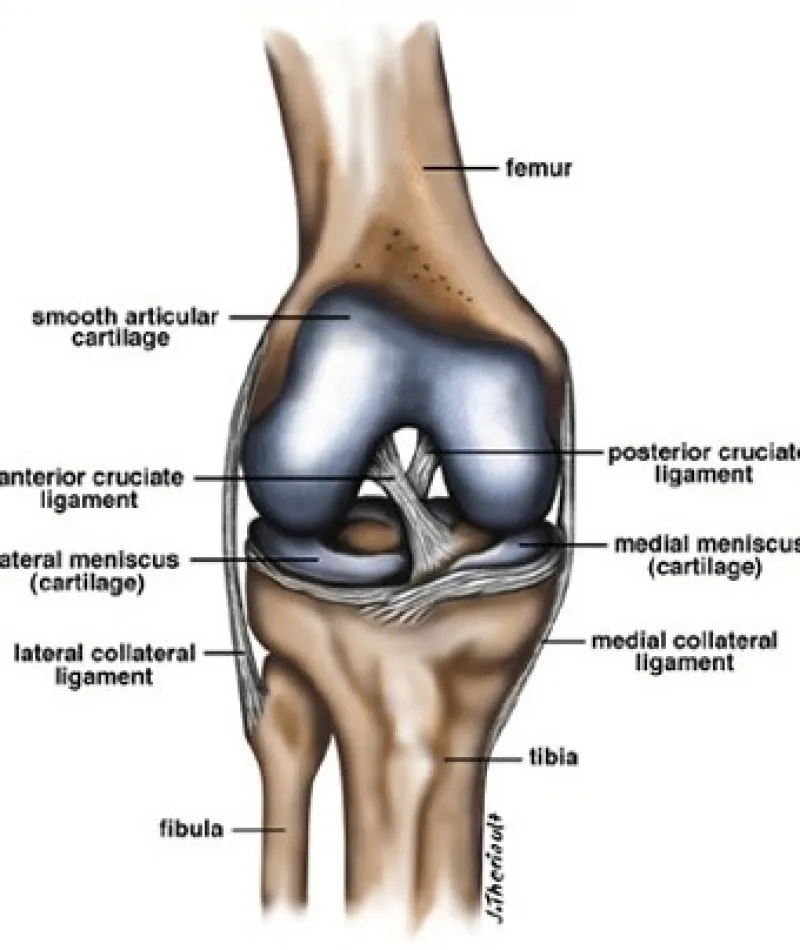 Detailed labeled diagram of a normal human knee showing bones, ligaments, cartilage, and meniscus structures.