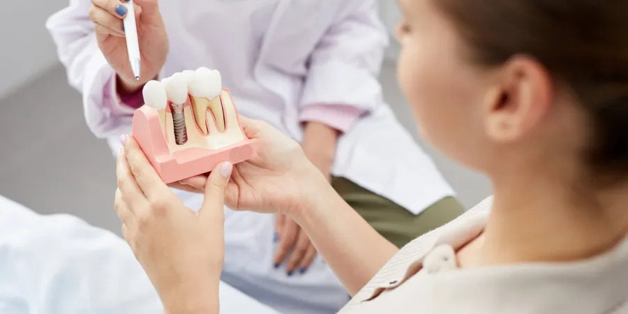 a woman holding a tooth implant model