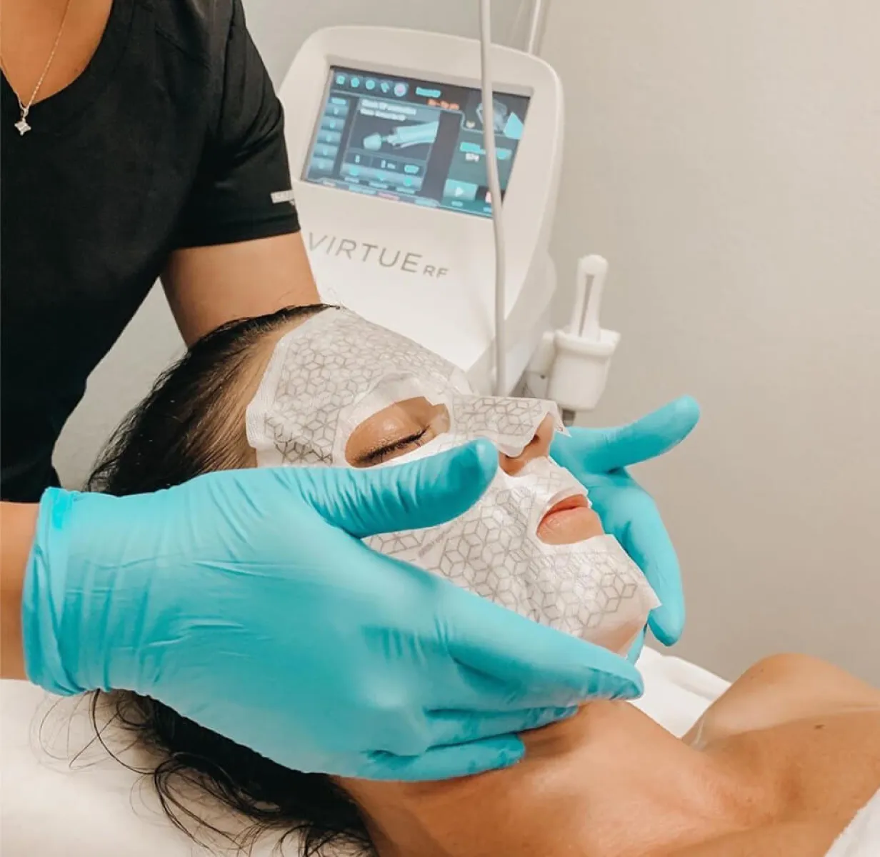 Rf Microneedling 