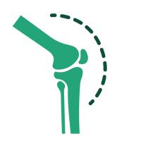 Simplified medical illustration of a human knee joint showing bones and patella with dotted outline.