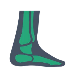 Illustration of human ankle and foot bones showing tarsal, metatarsal, and phalanges in green on dark background