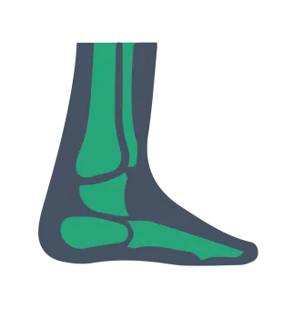 Illustration of human ankle and foot bones showing tarsal, metatarsal, and phalanges in green on dark background