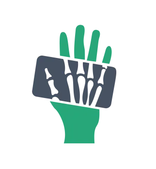 Green hand holding an X-ray image of fingers showing bones and joints in black and gray.