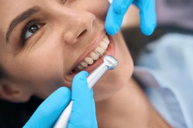 Close-up of a woman smiling during a dental cleaning with a dental drill and gloved hands.