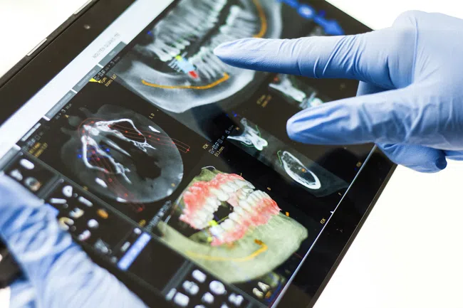Gloved hand pointing at dental X-ray images on a tablet showing teeth and jaw structures for diagnosis.