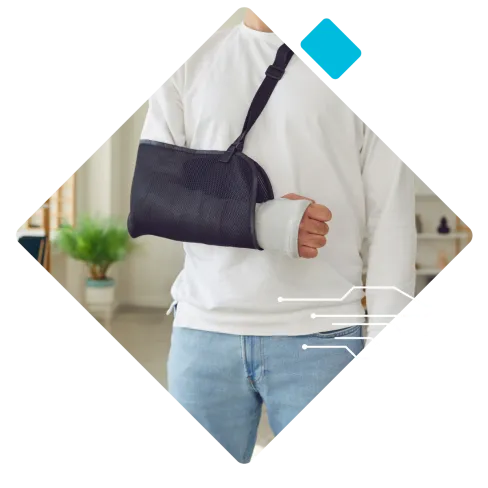 Person wearing a white shirt and a black arm sling supporting an injured forearm with a cast indoors.