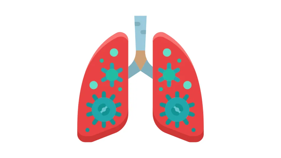 Sepsis Treatment