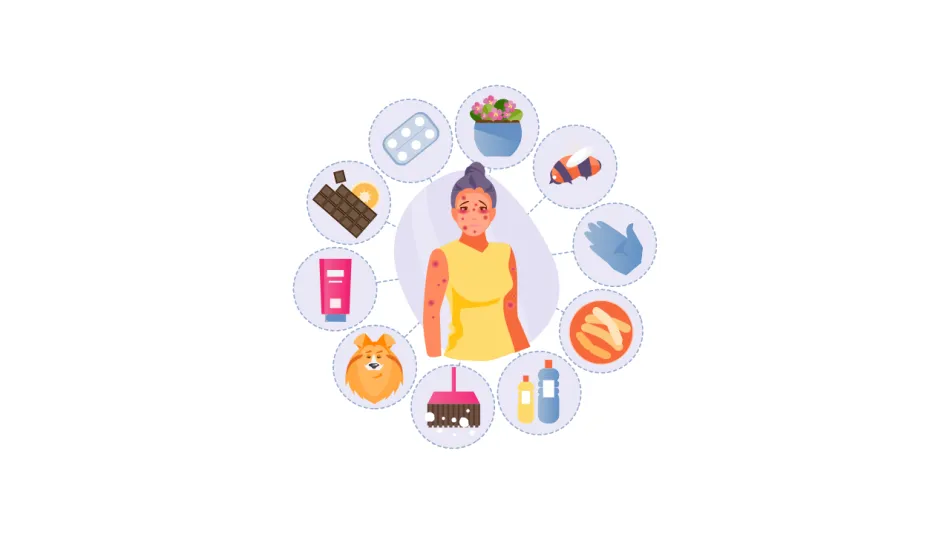 Allergic reaction and anaphylaxsis