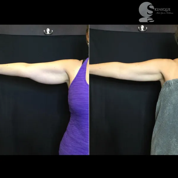 a person standing in front of a mirror posing for the camera
