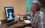 Man in plaid shirt pointing at spine x-ray image on computer screen in a medical office.
