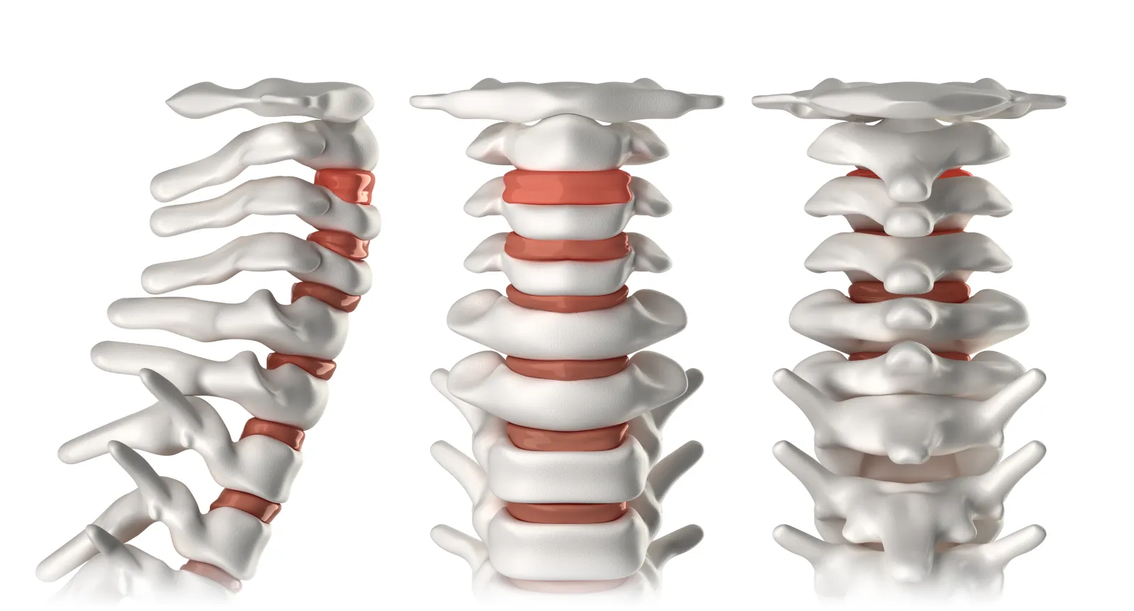 Compression of the spine, vertebral discs, and vertebrae