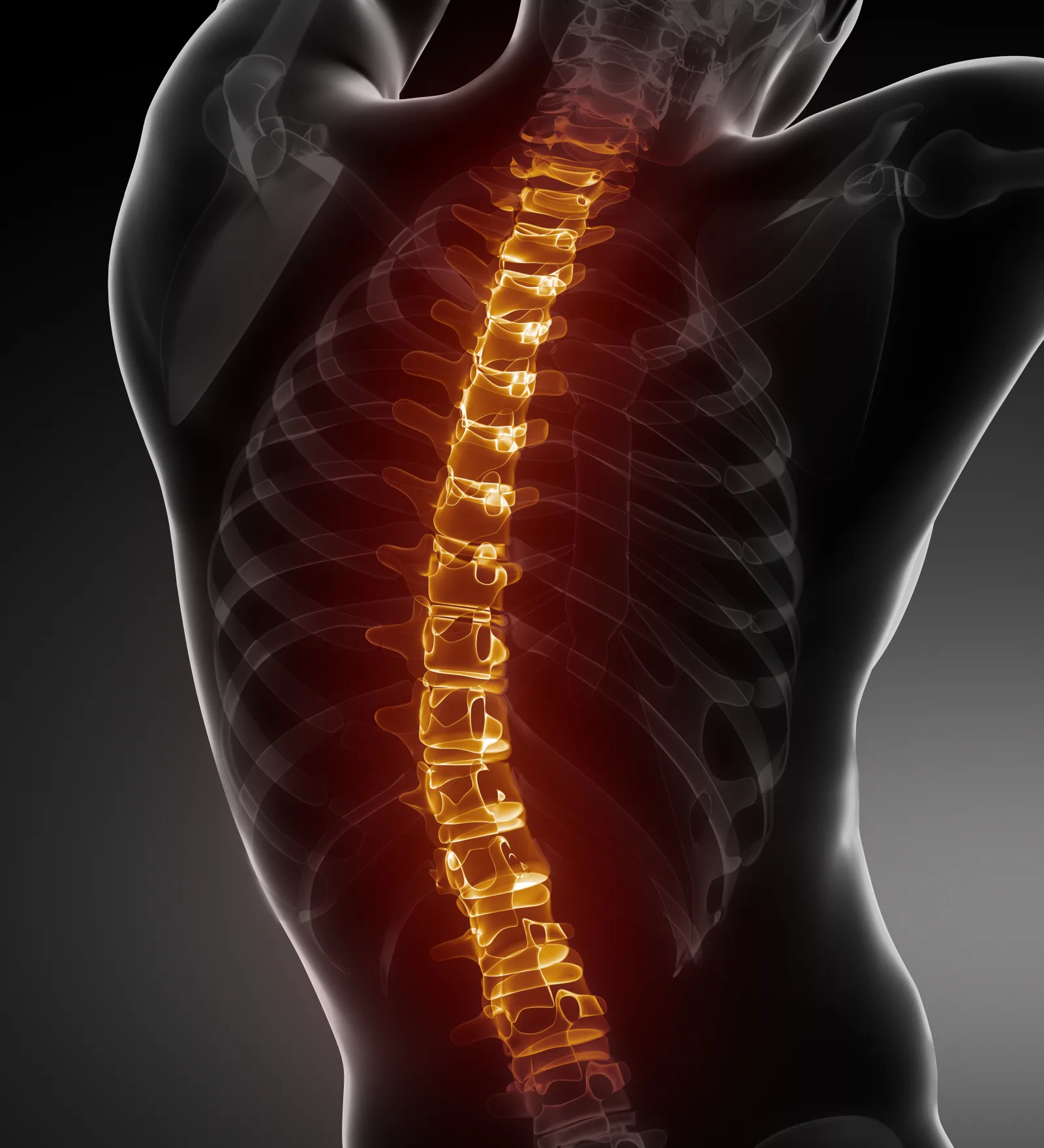 spine diagram