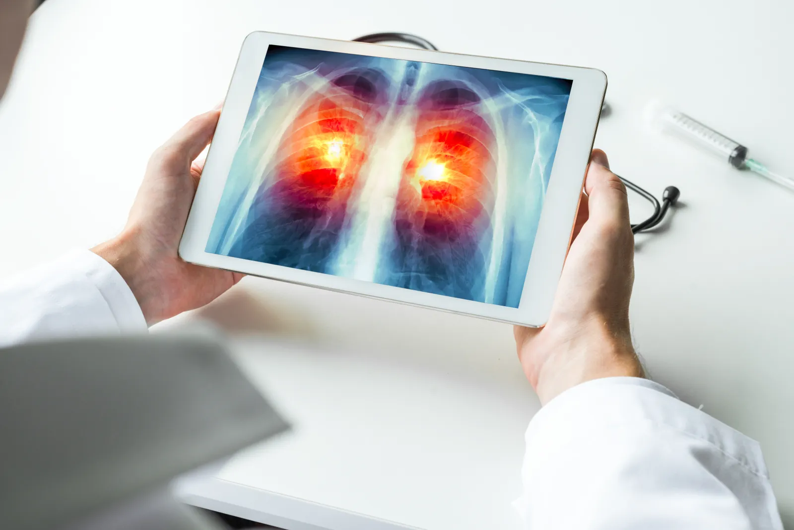 Doctor inspecting an x-ray of chest inflammation on a tablet to check  for possible lung cancer